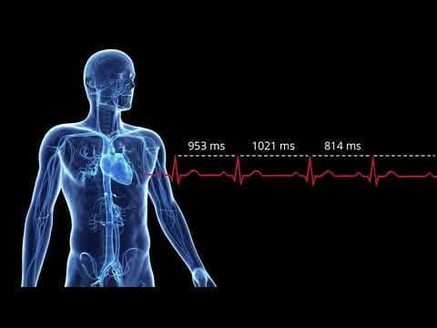Visualização de eletrocardiograma com a distância entre as batidas do coração